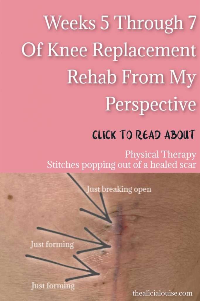Click here to read what happened during my weeks 5 through 7 of knee replacement rehab like stitches popping out of my healed scar! 